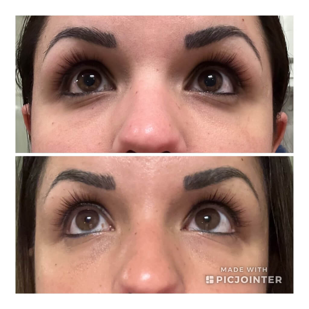 Woman's eyelashes before Gibson Pharmacy's Long Lash Kit and after